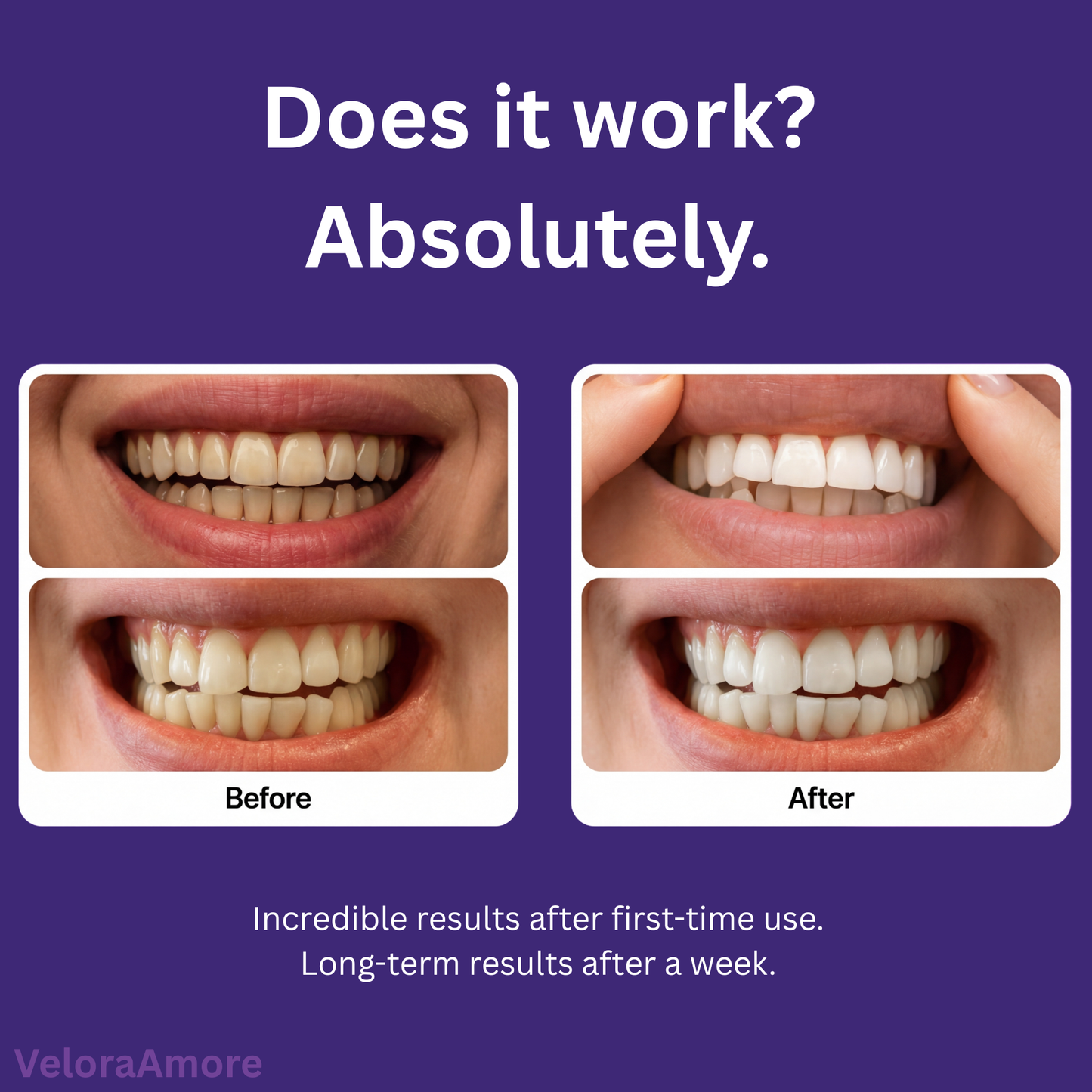 DR.DENT Purple Teeth Whitening Strips – Fast Brightening, Peroxide-Free Whitening