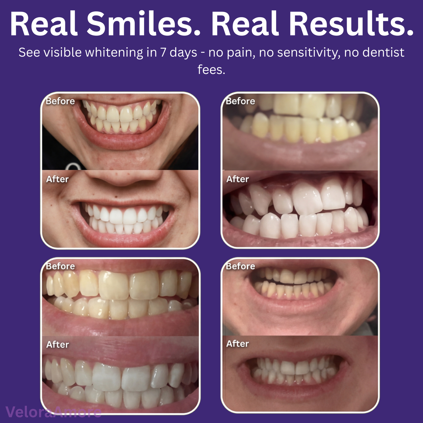 DR.DENT Purple Teeth Whitening Strips – Fast Brightening, Peroxide-Free Whitening